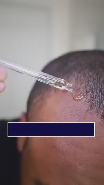 FEG PLUS Hair Growth Serum & Spray (50ml) – Organic & Rapid Results - For Men & Women