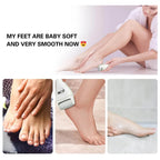 Rechargeable Electric Pedi Foot Filer – Callus & Dead Skin Remover